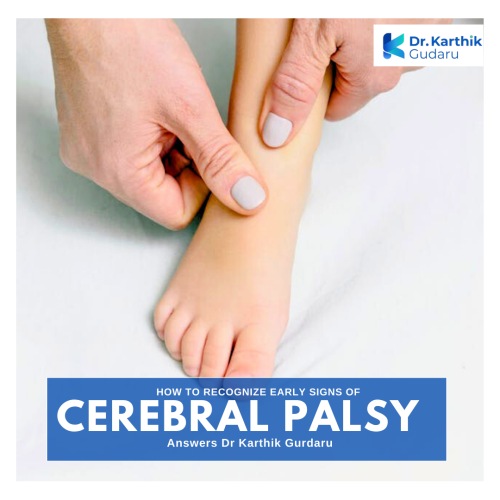 Cerebral Palsy treatment